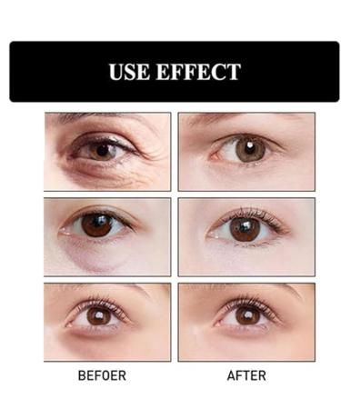 Instant Firm Eye Tightener - Anti-Aging Eye Bag & Dark Circle Cream - Brightening Firming Cream (1.05 OZ) - International Shipping Available - Buy Online on GoSupps.com
