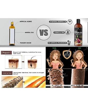 Onion Hair Oil 250 ML with 14 essential oils Multifunctional hair oilhair serum for hair growth hair treatment with argan pack 2 - Buy Online on GoSupps.com