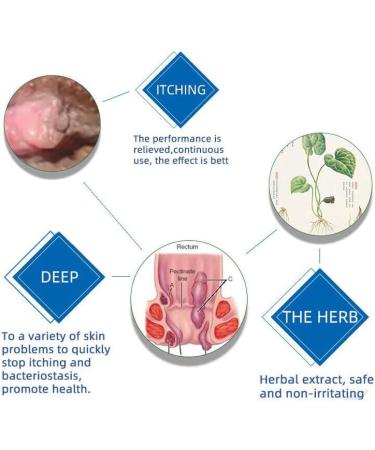 Healmusz Natural Herbal Hemorrhoids Ointment Healmusz Hemorrhoid Ointment Chinese Herbal Hemorrhoids Cream Organic Herbal Hemorrhoids Ointment 0.7Oz/20g (3pcs) - Buy Online on GoSupps.com