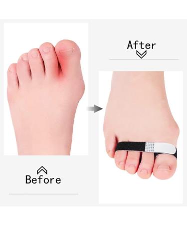 Buddy Tape Finger Straps - 12 Pack No Slip Hook and Loop Finger Splints for Broken Fingers - Washable and Reusable Toe Tape for Sprained Fingers - Buy Online on GoSupps.com