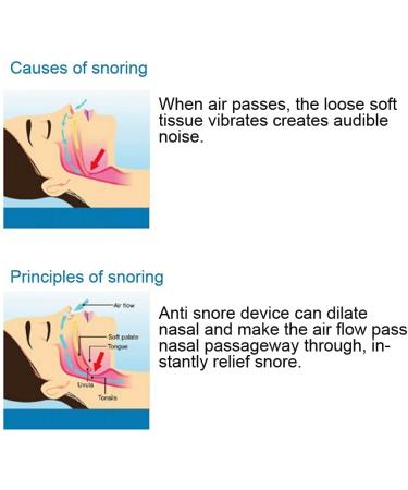 KUIKUI Upgraded Anti-Snore Nose Purifier with Air Filter Technology - Buy Online on GoSupps.com