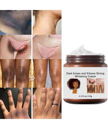 120g Crema Para Aclarar Las Axilas Y Partes Intimas Crema Aclaradora Para Piel Manchas En Cara Axilas Cuello Entrepierna Crema Blanqueadora Para Partes Intimas - Buy Online on GoSupps.com