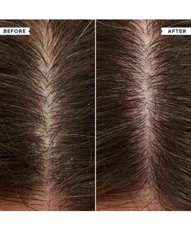  Philip Kingsley Philip Kingsley | Flaky/Itchy Scalp Conditioner | Anit-Dandruff Conditioner For Flaky Itchy Dry or Oily Scalps | Cleansing Scalp Care | Moisturizes Soothes and Detangles | 1000ml Refill Pouch - Buy Online on GoSupps.com