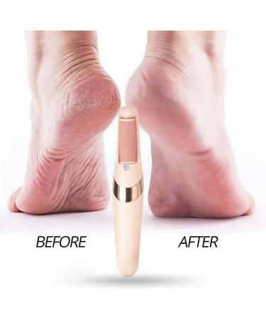 Rechargeable Electric Foot File Professional Callus Remover Portable Foot Scrubber Pedicure Tool for Silky Feet - Buy Online on GoSupps.com