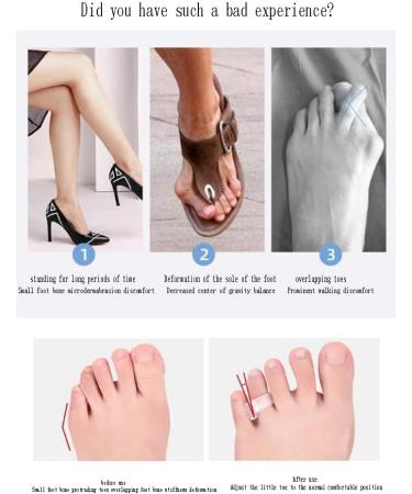 DEAVER Toe Separator & Thumb Valgus Corrector - Soft Silicone Gel - 1 Pair - Buy Online on GoSupps.com