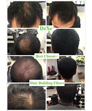 Black Hair Building Fibers - Hair Loss Concealer Powder for Thicker Hair - 0.77oz - For Women and Men - Buy Online on GoSupps.com