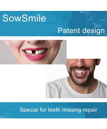 Snap Smile Dental Replacement Tooth - Repair Missing Teeth Gap | Perfect Smile Veneers for an Instant Smile Makeover - Buy Online on GoSupps.com