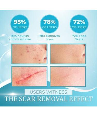 PICKX Organic Scar Removing Gel - Keloid & Surgical Scar Removal Cream - Lightens Scars and Acne Marks - Gentle on Sensitive Skin (1PC) - Buy Online on GoSupps.com