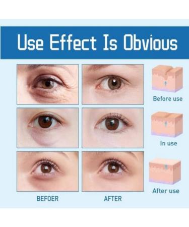 OPENEYES & HIMSE Awaken Peptide Eye Gels - Reduce Puffiness, Dark Circles, and Wrinkles - Buy Online on GoSupps.com