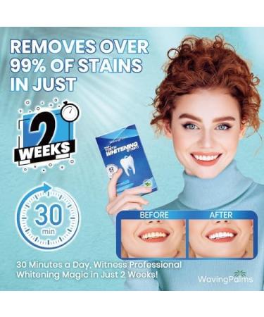 Bande Blanchiment Dentaire Whitening Strips:Kit de Blanchiment Dentaire Professionnel 42 Bandes (21 Applications) claircissement Rapide et Soin Doux pour les Dents Menthe 42 unit (Lot de 1) - Buy Online on GoSupps.com