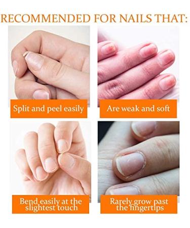 Nail Tek Nail Recovery Kit: Cuticle Oil, Strengthener, Ridge Filler - Restore Damaged Nails in 3 Steps - Buy Online on GoSupps.com