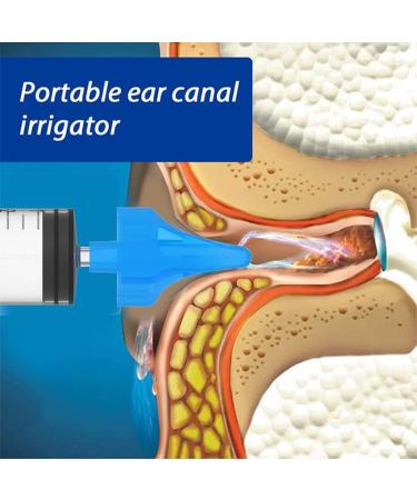 Ear Wax Cleaner Syringe - 1PC 10ML Ear Irrigation Tool for Adults & Children - Buy Online on GoSupps.com