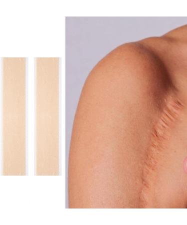 4Pcs Scar Sticker Set | Reduce Infection & Lighten Pigmentation | Acne Scar Removal | Skin Repair Sheet | Style A Color S - Buy Online on GoSupps.com
