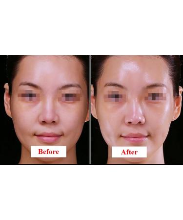 ULTIMATE Stem Cell + PDRN Healing Booster Overnight Serum | Reduce Wrinkles & Discoloration - 10ml x 5 Vials | Buy Internationally - Buy Online on GoSupps.com
