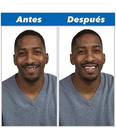 Perfect Smile - Achieve Your Ideal Smile with Our Premium Dental Products | International Shipping Available - Buy Online on GoSupps.com