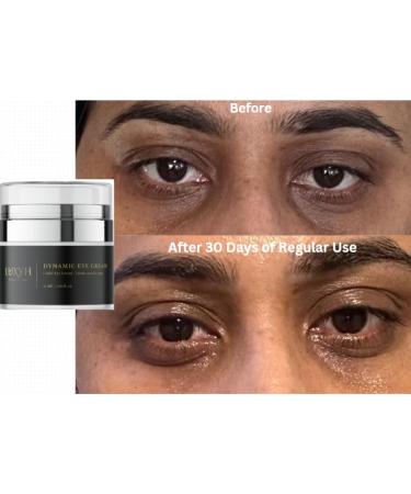 Luxyh Dynamic Firming Eye Cream | Under Eye Cream For Puffiness And Fine lines Under Eyes | Isopropyl Myristate + Squalene + Citric Acid | Hydrating - Buy Online on GoSupps.com