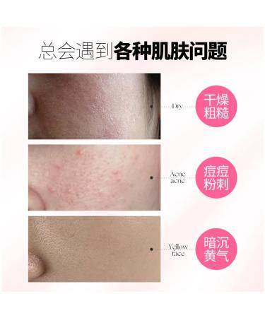 WEERSHUN Pink Yingrun Aloe Vera Gel - Moisturizing After-Sun Repair Skin Care Product - Buy Online on GoSupps.com