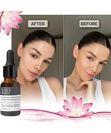 Lotus Squalane Healing Facial Oil - Hydrating & Soothing for All Skin Types (15ML) | Vitamin Rich Moisturizer for Dry Oily & Acne Prone Skin - Buy Online on GoSupps.com