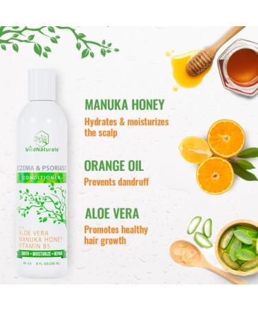 Anti-Dandruff Eczema Psoriasis Conditioner for Dry Scalp - Deep Treatment for Seborrheic Dermatitis - 8 fl oz - Buy Online on GoSupps.com