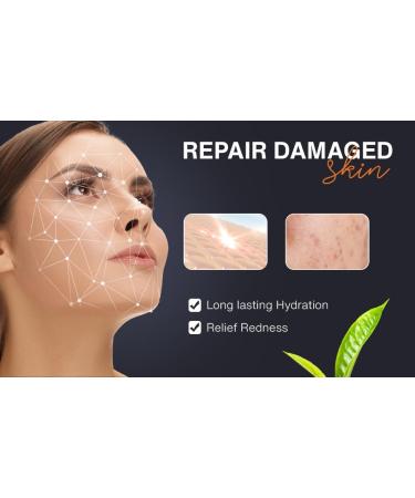 Snail Mucin Moisturizer Cream for Dry & Acne-Prone Skin | Dermatologist Tested Paraben & Sulfate-Free Face Cream - Buy Online on GoSupps.com