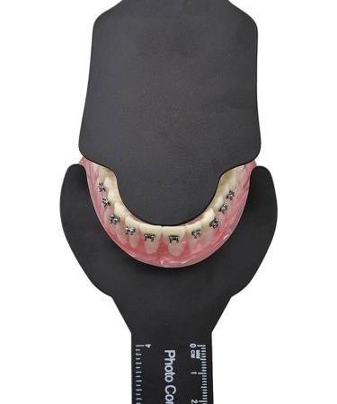 Buy Laugherer Dental Photo Background Board | Orthodontic Photography Contrast Board - C-2A | International Shipping Available - Buy Online on GoSupps.com