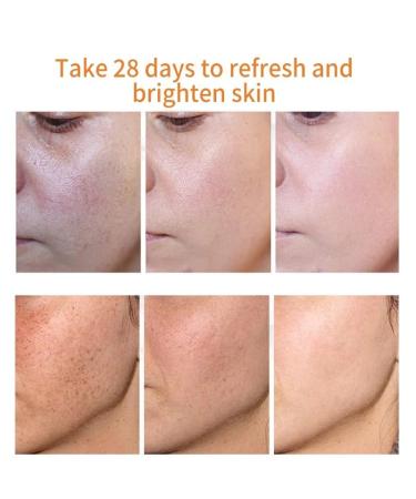 Axnoocy Dark Spot Remover Cream - Instant Results for Blemish, Melasma, Freckle, Sun Spot Removal - 0.71fl.oz - Suitable for All Skin Types - Buy Online on GoSupps.com