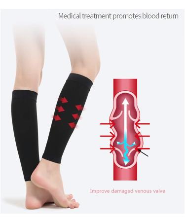 Buy Aciyd Elastic Leg Compression Stockings | Comfortable Durable Cuff for Varicose Veins & Edema Relief (23-32mmHg) - Black M - International Shipping Available - Buy Online on GoSupps.com