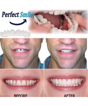 Flipped Warm Dentures - 2 Pairs of Plug-In False Teeth | Cosmetic Temporary Artificial Teeth - Buy Online on GoSupps.com