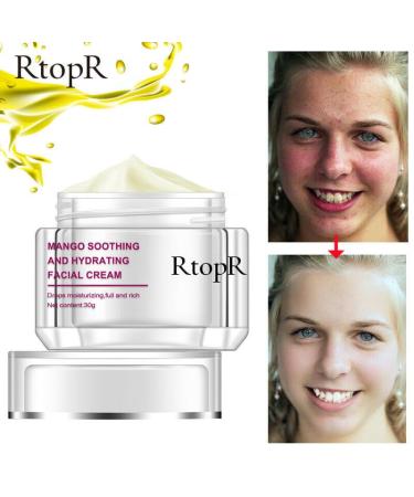 RtopR Mango Soothing & Hydrating Facial Cream | Anti-Dryness & Purifying Skincare - 30g | International Shipping Available - Buy Online on GoSupps.com