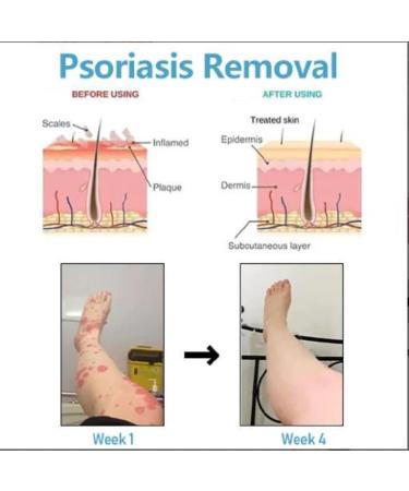 Spayeim Blueshot Turmalin-Ion Magnet Fiber Ice Socks | Body Forming Beige Stretch Socks - Ship Worldwide - Buy Online on GoSupps.com