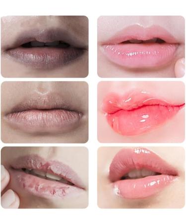 3Pcs Lip Balm for Dark Lips 15ml Fresh Pink Lip Balm Whitening Cream Lip Balm for Smokers Lip Balm for Men and Women - Buy Online on GoSupps.com