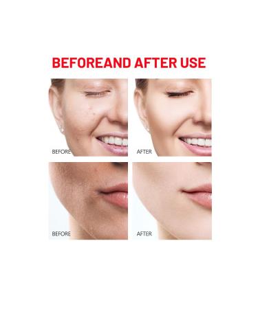 DISAAR Beauty Pomegranate Vitamin E Facial Foam Wash Anti-Aging Revitalizing Skin Nourishing Moisturizing Essence 100g / 3.38fl.oz - Buy Online on GoSupps.com