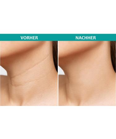 Pinou Anti-Fold Pads - Reusable Anti-Aging Cream for Neck & Cleavage | Moisture & Fold Reduction - Buy Online on GoSupps.com