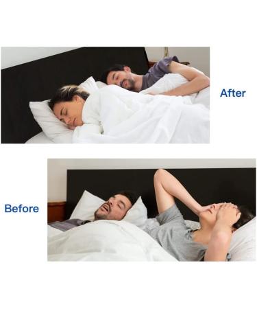 Automatic Snore Stopper Double Turbo Anti Snoring Nasal Nose Device - Blue 3 - Buy Online on GoSupps.com