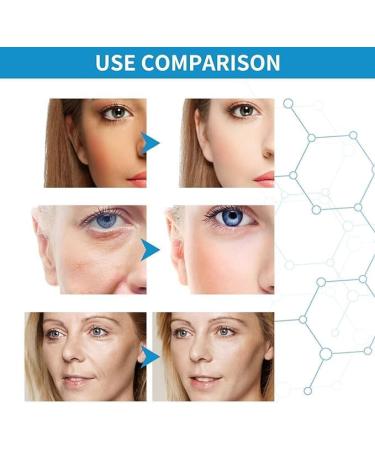 TAIMEI 2PCS Hyalu B5 Serum Condensem a Botox Face Serum Anti Aging Collagen Serum Hydraulic Acid Serum for Face 30ML - Buy Online on GoSupps.com