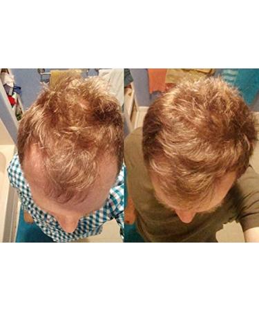 DIY AHK Copper Peptide Solution for Scalp Hair - AHK-Cu Formula - Buy Online on GoSupps.com