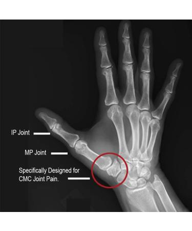 Comfort Cool Thumb CMC Restriction Splint - Beige Left Medium Plus (7-7/8" to 8-1/4") | International Shipping - Buy Online on GoSupps.com