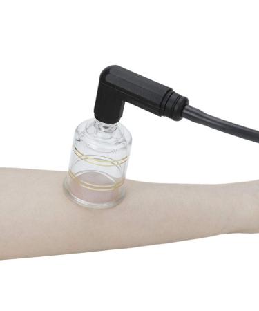 Cupping Jars Set - Traditional Chinese Cupping Tools for Pain Relief & Qi Circulation | International Shipping - Buy Online on GoSupps.com