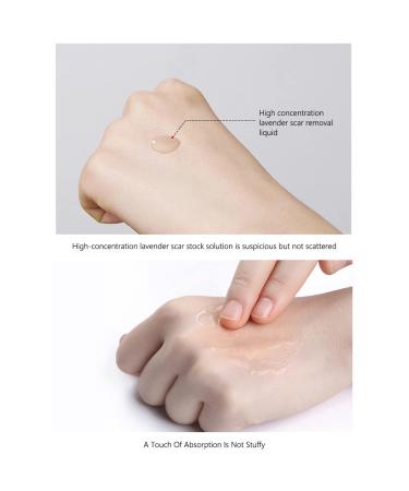 AICHUN BEAUTY Lavender Extract Scar Repair Essence | Anti-Scar Essential Oil for Smooth Skin | 30ml - Buy Online on GoSupps.com