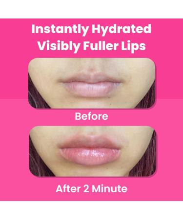 One Minute Lip Plumper Patch - Instant Hydration with Hyaluronic Acid & Collagen | Tarel Laboratory - Buy Online on GoSupps.com