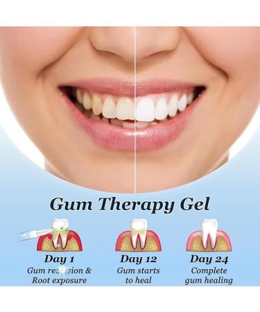 Lovilds Gums Therapy Gel - Effective Gum Care & Relief | Lovilds Gel Experience - Buy Online on GoSupps.com