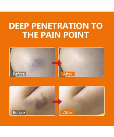 Fast Absorbing Fragrance-Free Relief for Bruises Joint Pain & Muscle Soreness - International Shipping - Buy Online on GoSupps.com