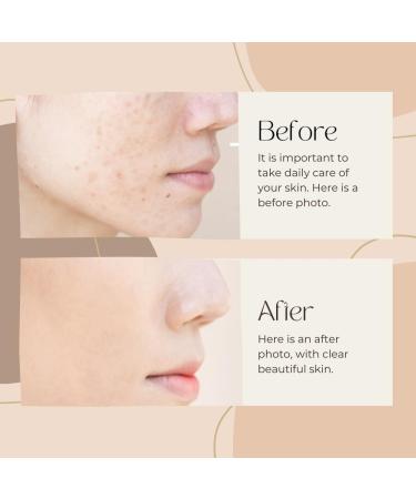  BRITAINS BEAUTY 4 in 1 Vitamin C Face Serum - Organic Skin Care for Whitening Moisturizing Anti-Aging and Acne Control for All Skin Types - 30ml - Buy Online on GoSupps.com