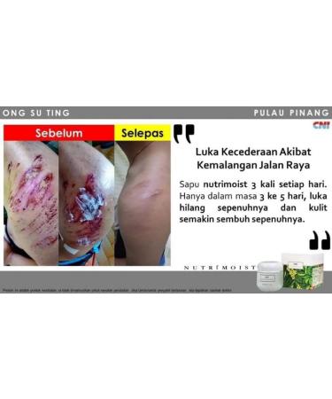 CNI NUTRIMOIST - 120 g - Buy Online on GoSupps.com