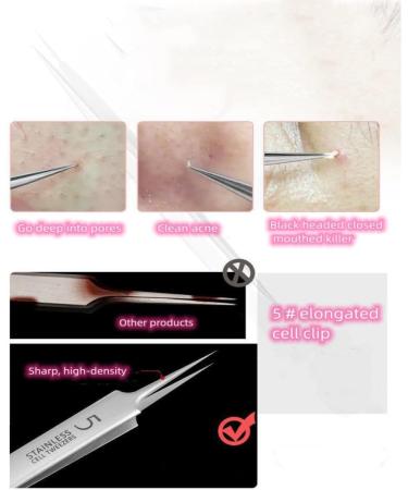Professional Blackhead Remover Extractor Kit - Acne & Whitehead Removal Tool - Buy Online on GoSupps.com