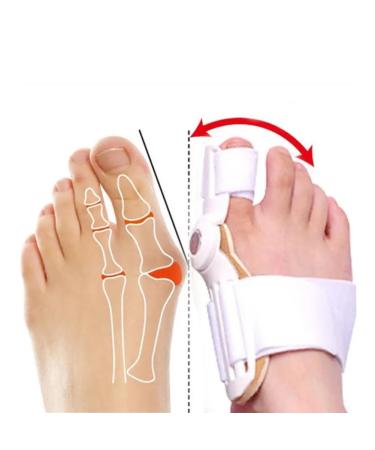 Orthopedic Toe Separator & Hallux Valgus Correction Set | Relieve Inflammation & Correct Thumb Valgus - Adjustable Carrier - Buy Online on GoSupps.com