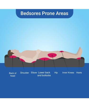 VAYUP Soreze Gel | Bed Sores Prevention Gel | Skin Protectant Gel Silicone Barrier Layer To Prevent BedSores | 30 GM (Pack of 1) - Buy Online on GoSupps.com