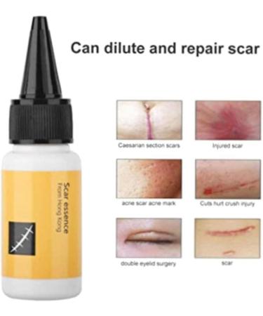 Delicate Skin Scar Treatment Serum - Acne Scar Removal & Repair Cream - 20ml - Buy Online on GoSupps.com