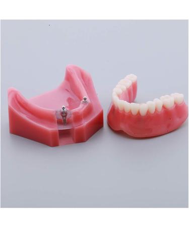 Fhuili Teeth Model for Education | Dental Implant Repair & Communication | Red Dentition Simulation Tool - Buy Online on GoSupps.com