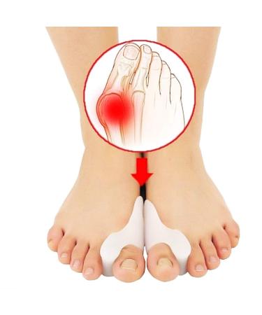 Hallux Valgus Corrector - Gel Medical Silicone - Anti-Chafing Pain Relief Separator - 6 Beige Pieces - Best Gift Idea - Buy Online on GoSupps.com